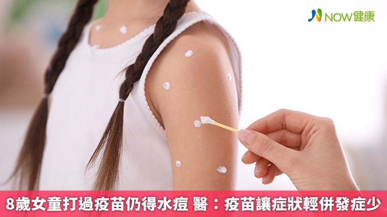 8歲女童打過疫苗仍得水痘 醫:疫苗讓症狀輕併發症少