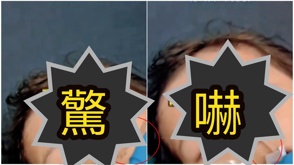 4歲女童「體內塞1KG異物」!15cm活體爬出來「震撼片」嚇壞家長