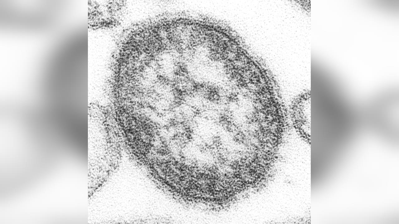 日本麻疹疫情升溫　東京新宿區小學爆集體感染停課5天