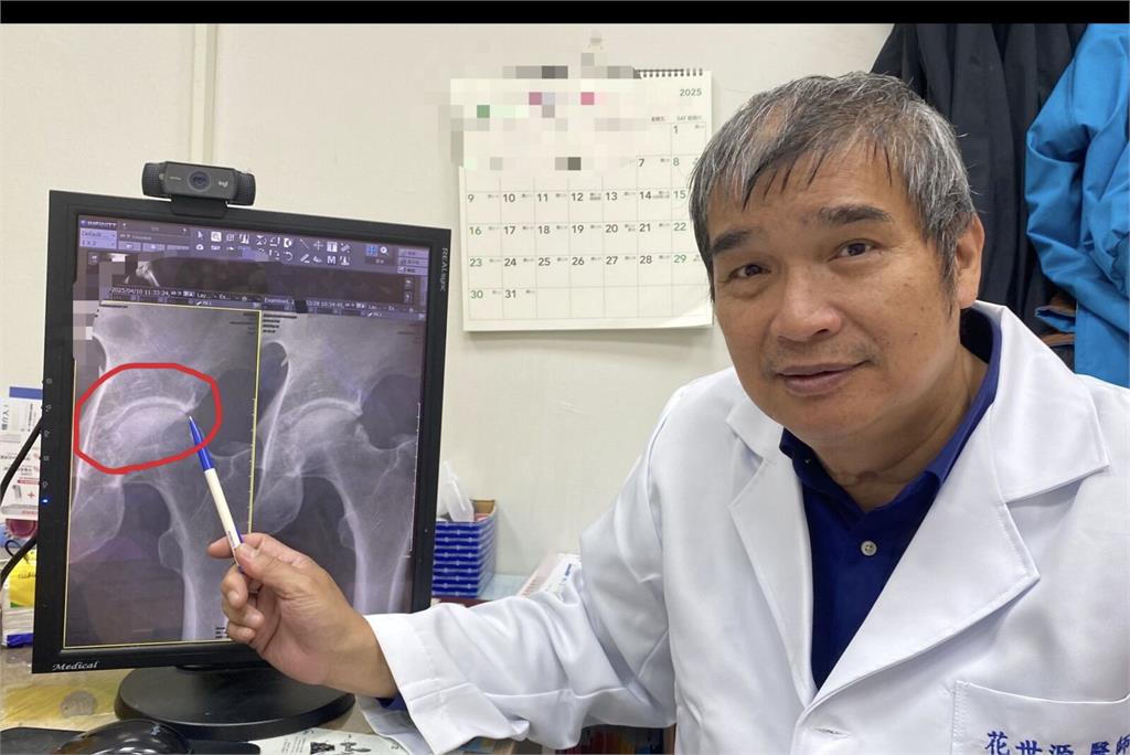 走路沒事「一蹲就痛」？   長時間深蹲小心髖關節夾擊症候群