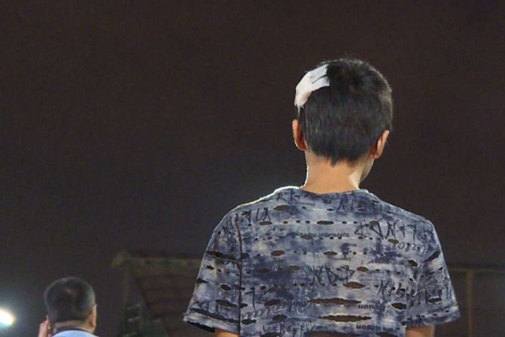 2少年遭安全帽痛毆 稱對方「打錯人」