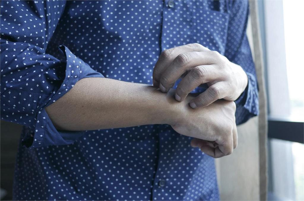 蕁麻疹發作不只皮膚症狀! 她「喉嚨腫脹、呼吸困難」三度送急診