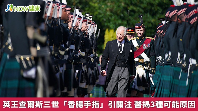英王查爾斯三世「香腸手指」引關注　醫揭3種可能原因