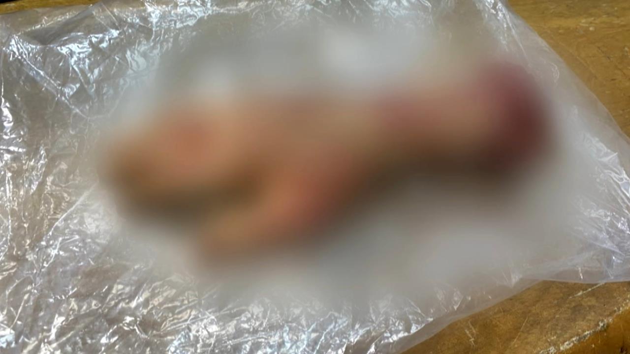 嚇死人！台中馬路驚見「血淋淋斷掌」　警一查竟是...