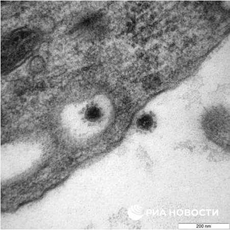 武肺最強變種Delta「真面目」曝光　俄羅斯公布顯微鏡下真實樣貌