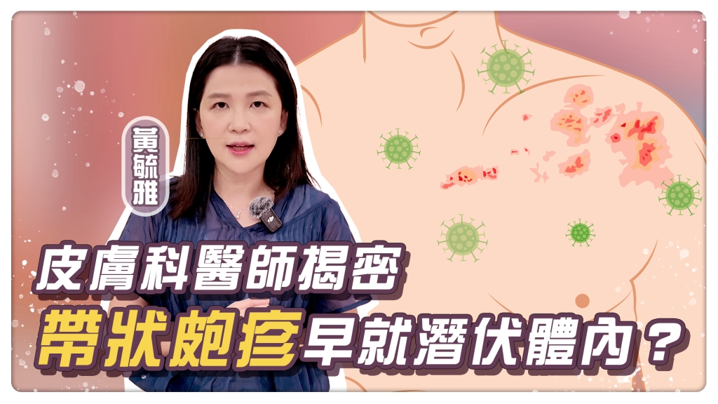 皮膚又痛又癢長水泡 恐遭「帶狀疱疹」纏身?提升保護力「這年齡族群」可施打疫苗