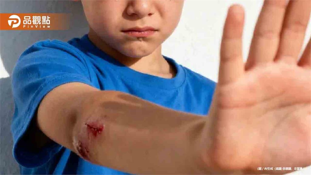 已聲請保護令!幼童洗碗一半遭父「持槍射大腿」再賞3巴掌