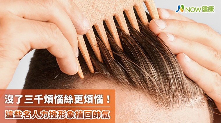 沒了三千煩惱絲更煩惱！ 這些名人力挽形象植回帥氣