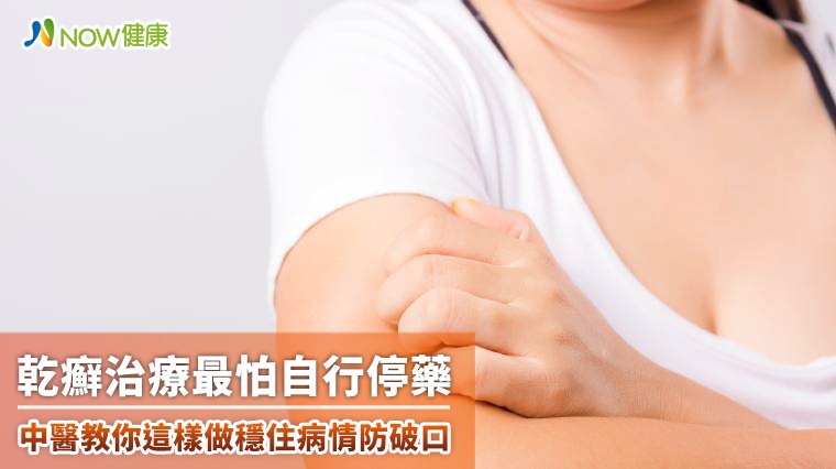 乾癬治療最怕自行停藥 中醫教你這樣做穩住病情防破口