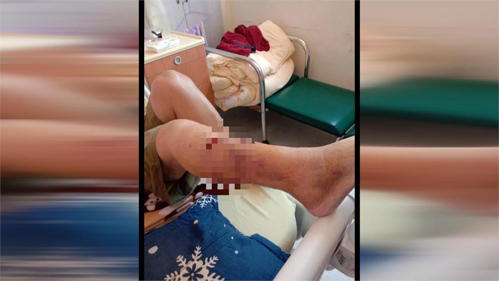 獒犬半個月咬傷2居民 動保處:考慮強制沒入犬隻