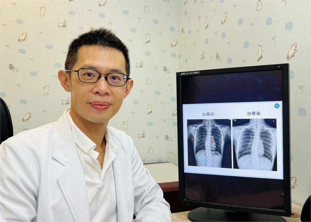 13歲童「大口深呼吸」竟出大事！   少見縱膈腔氣腫上身傳劈啪聲