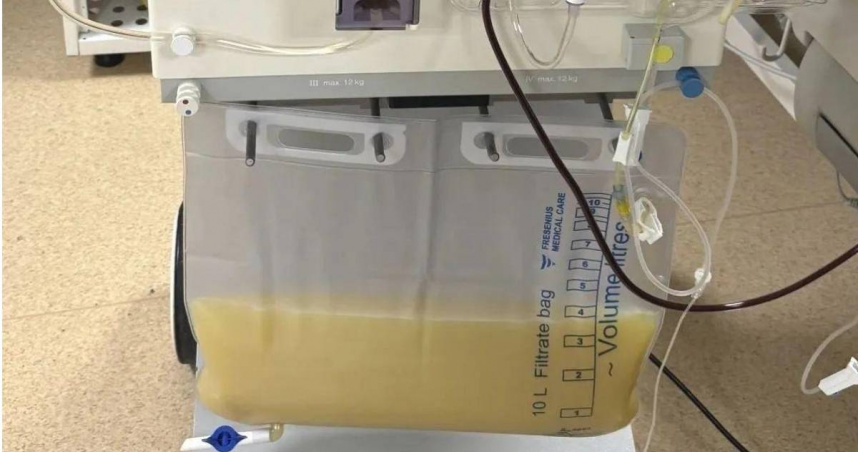 40歲總經理應酬多「血液變奶白色」 就醫被送進ICU!醫:易變成重症