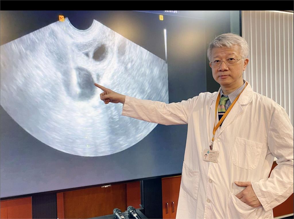 41歲女求做試管嬰兒驚見「癌細胞」   取卵3年後順利抱孩