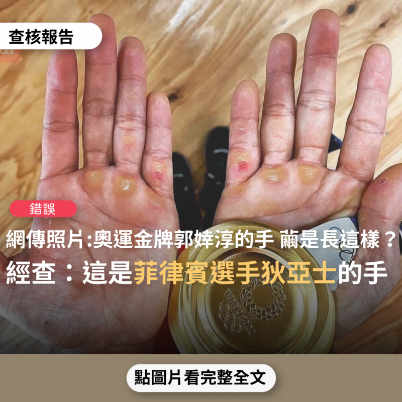事實查核／【錯誤】網傳照片「奧運金牌郭婞淳的手，繭是長這樣子的」？