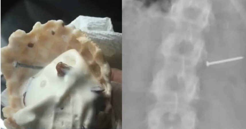 婦吃冰淇淋誤吞金屬釘喪失生育能力　連鎖店須賠4.5億