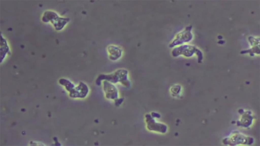 快新聞／食腦變形蟲最終檢體1件陽性　未與親水設施用水交流