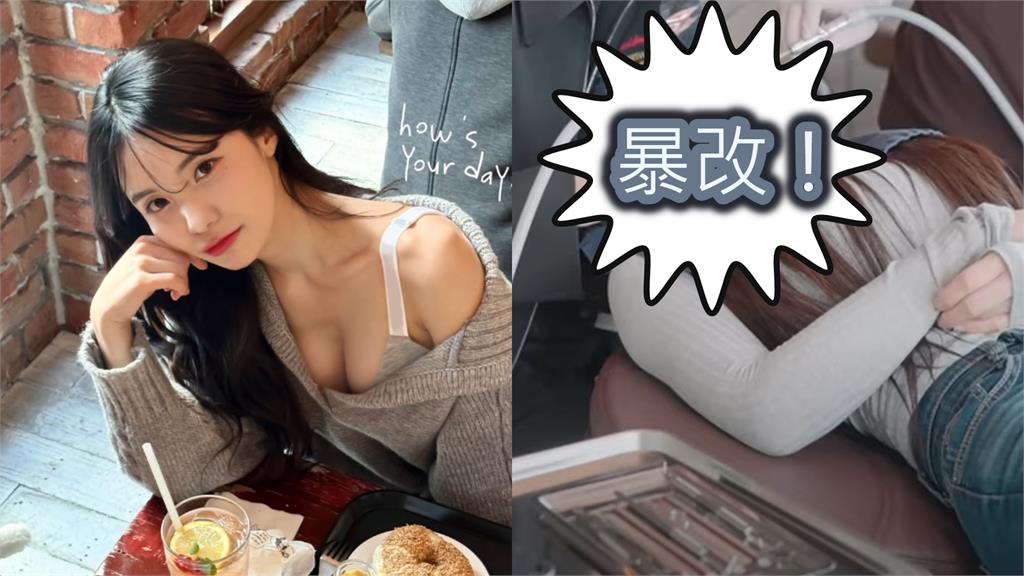 李多慧「1部位」整形大升級!公開「手術過程」曬驚人成果…全網看呆:哇