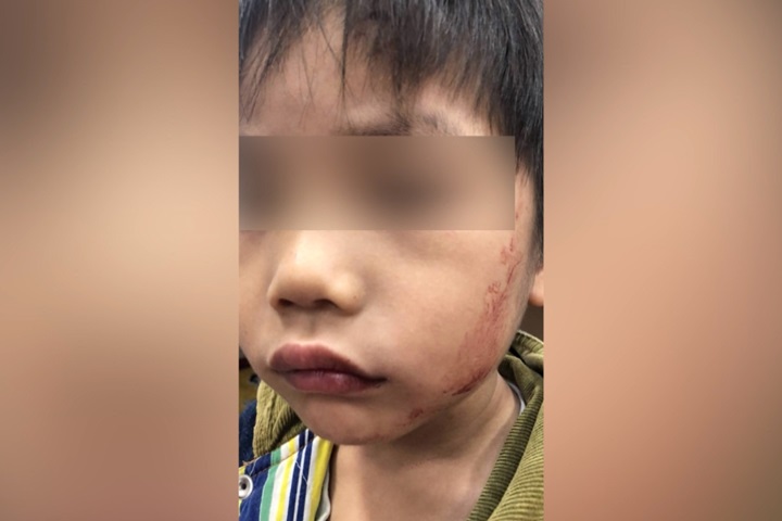 社會悲歌！32歲母疑教唆長女虐打弟弟