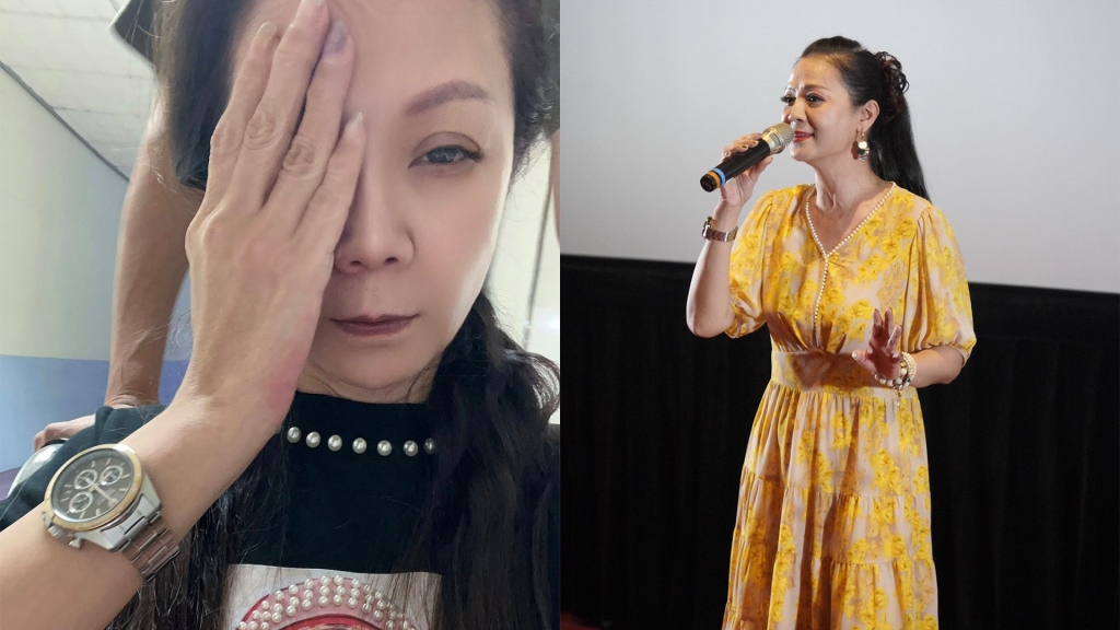 高欣欣凌晨出意外!老公急推輪椅送醫 嚴重傷勢曝光:眼前一片模糊