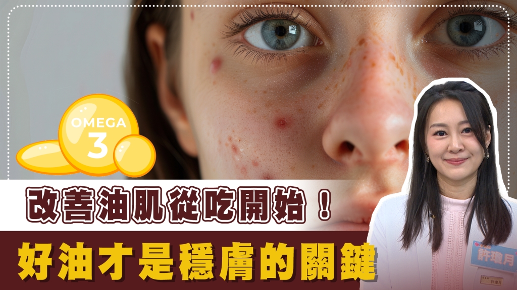 擺脫痘痘狂冒、油光滿面　營養師：皮脂腺造成膚況惡化都因「這3成份」！