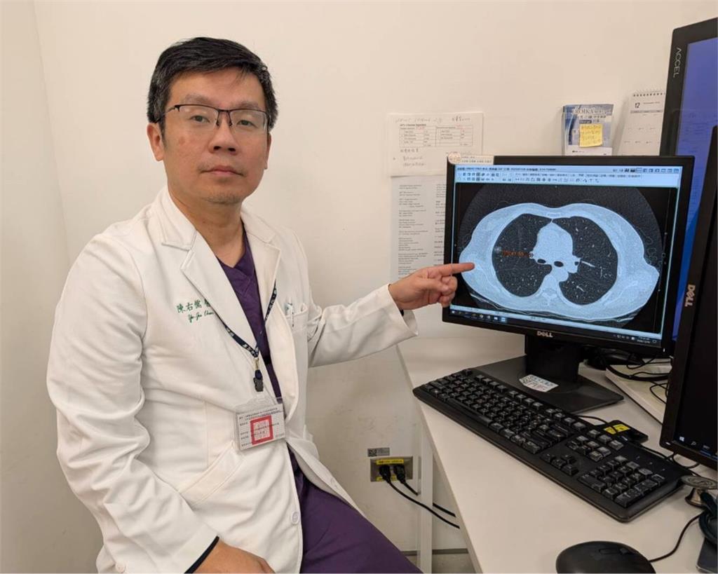 不抽菸也有風險 恩主公醫院示警肺癌家族史關鍵