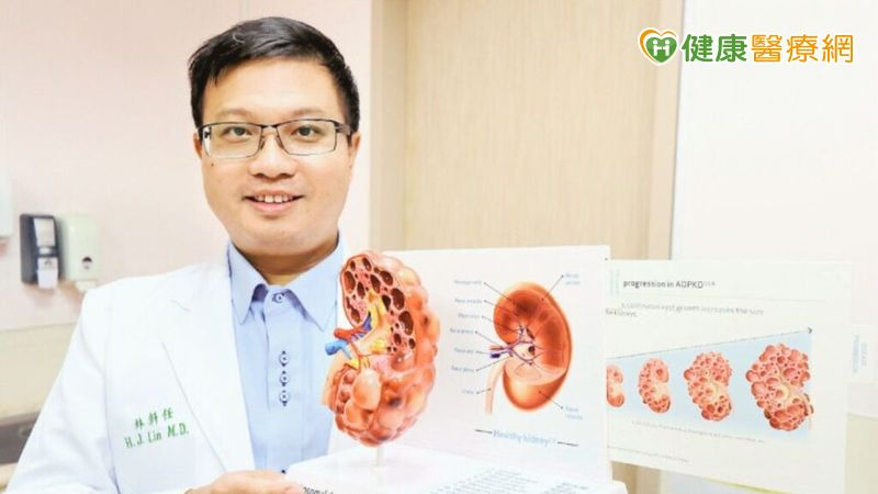 早期發現可延緩洗腎 醫師:「這個」檢查可發現多囊腎