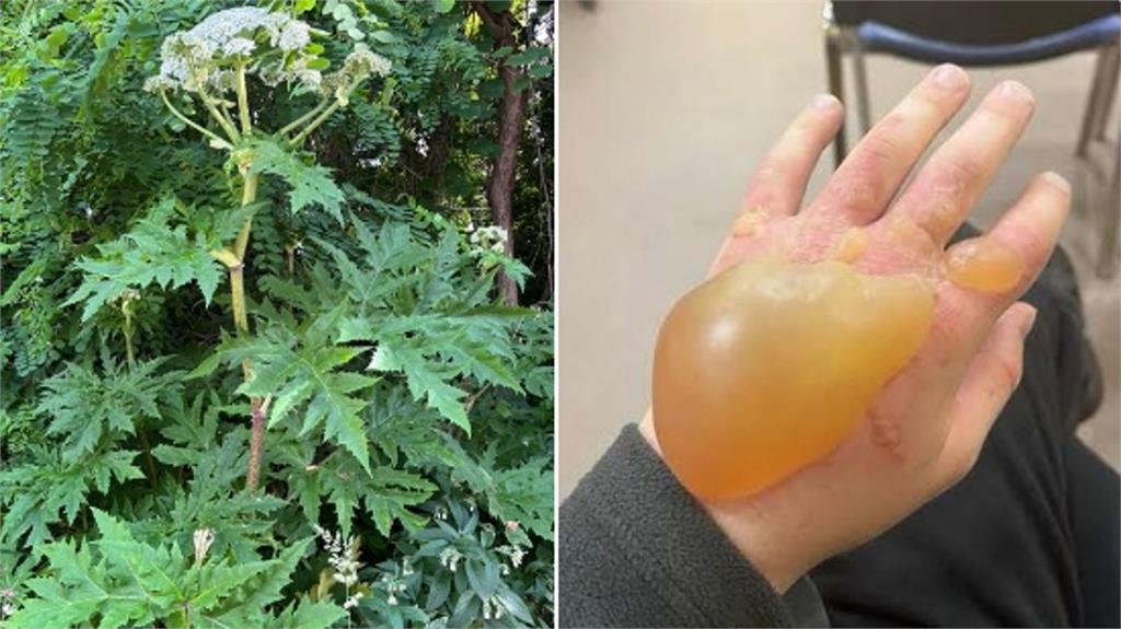 赴日旅遊注意!日本疑出現「世界最危險植物」 碰到恐有失明風險