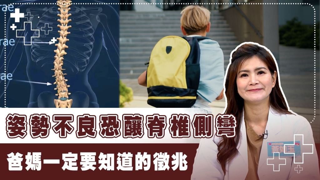 把握黃金治療時期!3招矯正脊椎側側彎家長必看!