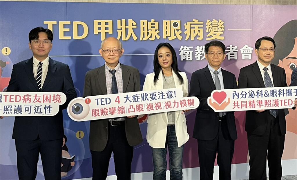 金鐘影后照鏡「雙眼高低不一」竟罕見眼疾！   4大警訊常被忽略