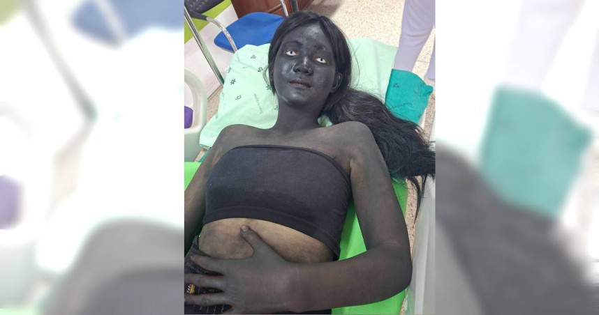 醫護衝學校急救！驚見「焦炭少女」嚇壞：以為接到鬼　驚悚畫面瘋傳