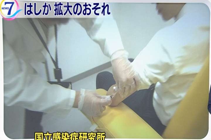 沖繩麻疹疫情擴大 群聚感染已56人確診