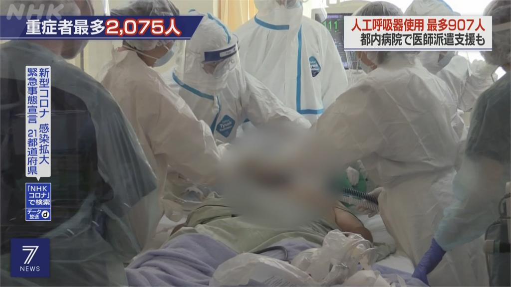 日本驗出首例Delta再變種！　確診者無出國史