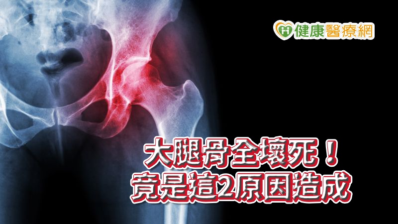 大腿骨全壞死！竟是這2原因造成 疼痛不容忽視