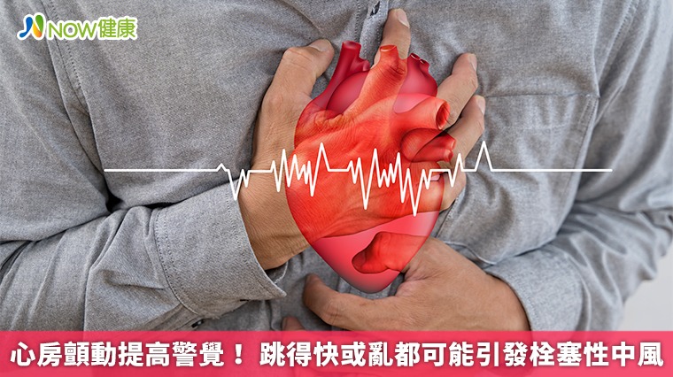 心房顫動提高警覺! 跳得快或亂都可能引發栓塞性中風
