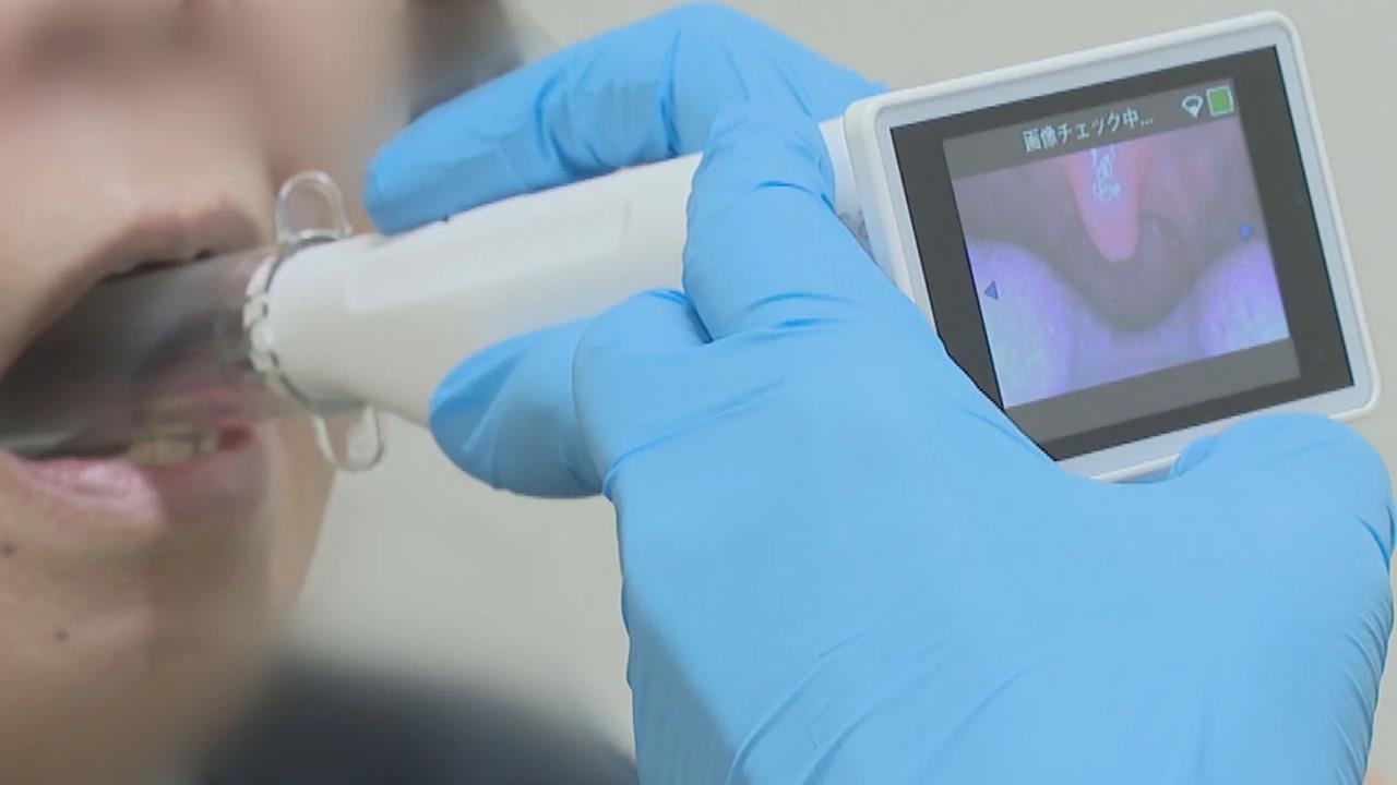 日本流感疫情持續升溫！　AI人工智慧助醫師即時診斷