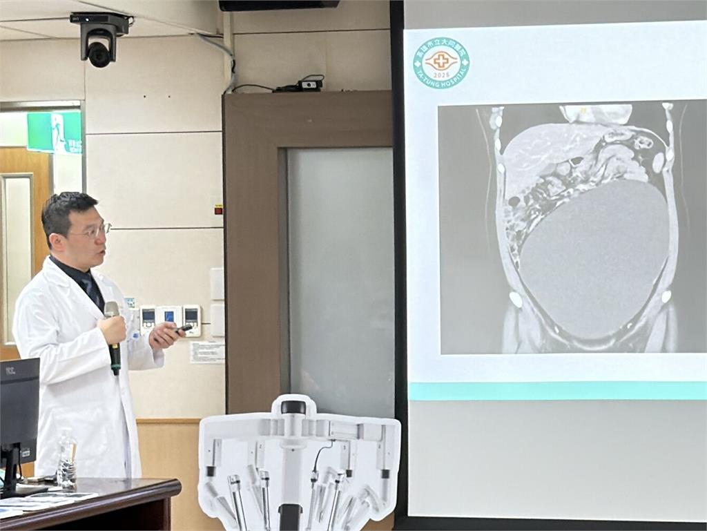 19歲女大生月經異常才知藏「30cm巨腫瘤」   機械手臂順利拆彈