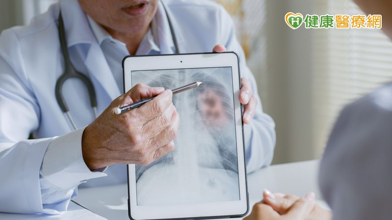 「肺部有陰影」不等於肺腺癌？手術怎麼評估？醫教治療與追蹤重點