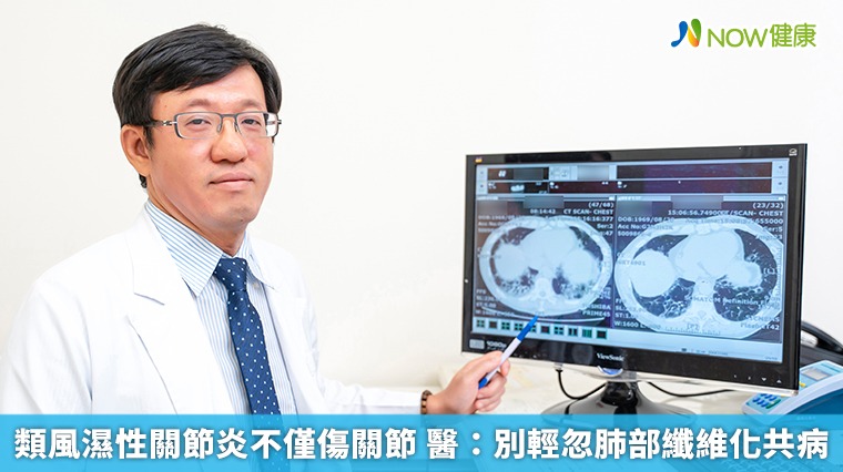 類風濕性關節炎不僅傷關節　醫：別輕忽肺部纖維化共病
