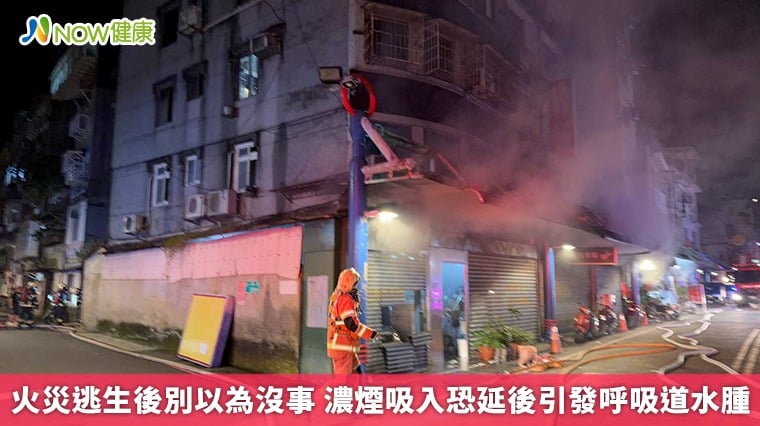 火災逃生後別以為沒事 濃煙吸入恐延後引發呼吸道水腫