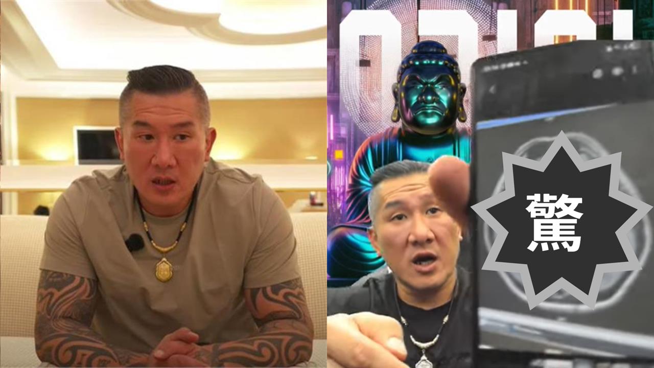 館長直播曬X光片自曝「腦有問題」!這1部分消失「驚見白色塊狀物」險癱瘓