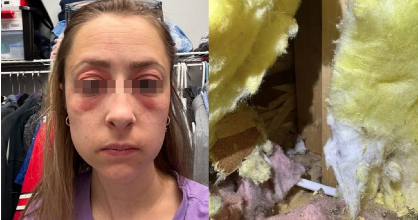 人妻砸千萬買夢想屋「住2天怪病連發」　自拍爛臉照意外揭超髒真相