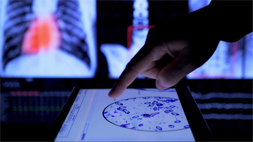 癌症再登國人死因首位！北市今年整合性篩檢起跑，增胃癌與HPV檢測！