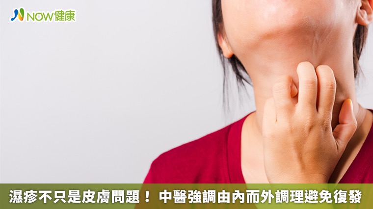濕疹不只是皮膚問題! 中醫強調由內而外調理避免復發