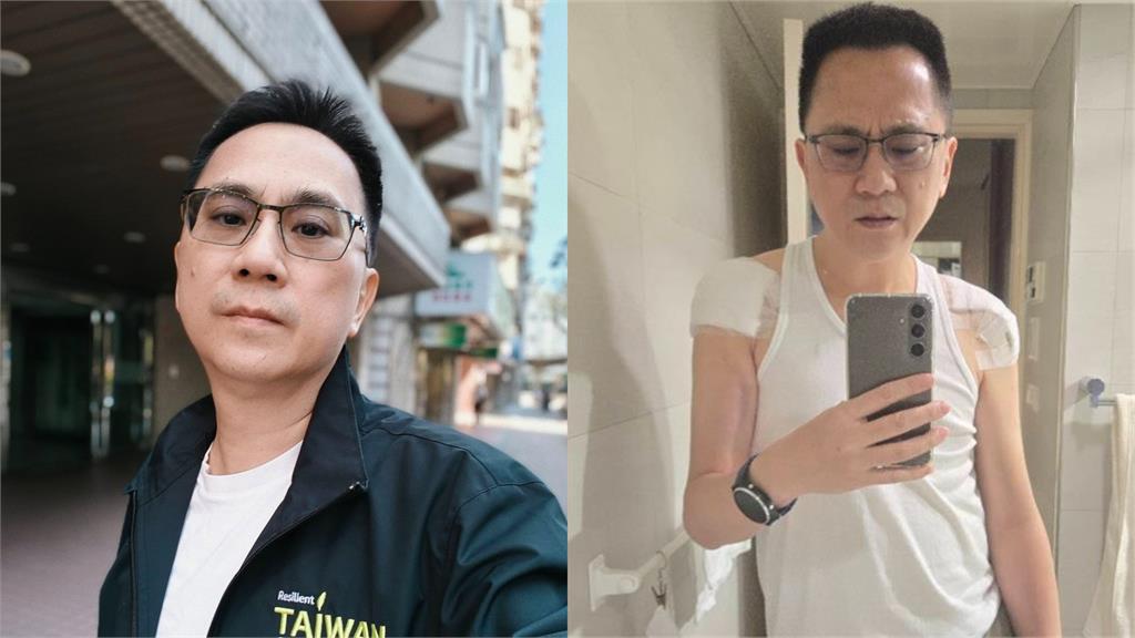 56歲486先生開刀激瘦！一早無預警「衝醫院報到」病況引網憂心：保重