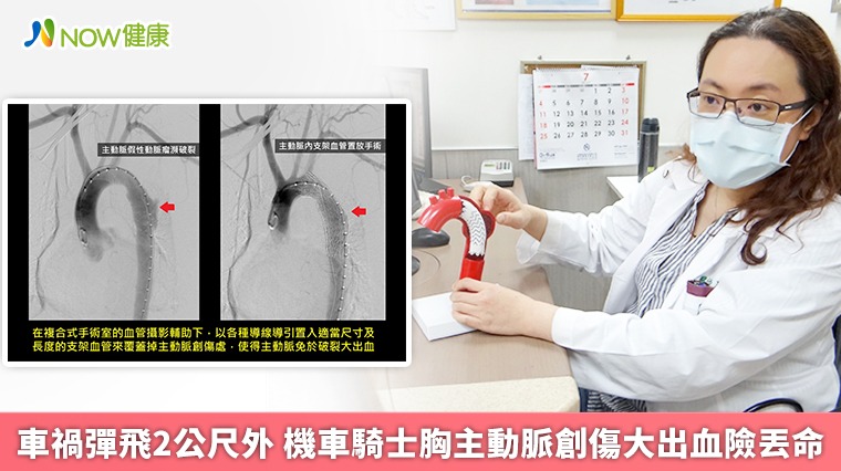 車禍彈飛2公尺外 機車騎士胸主動脈創傷大出血險丟命