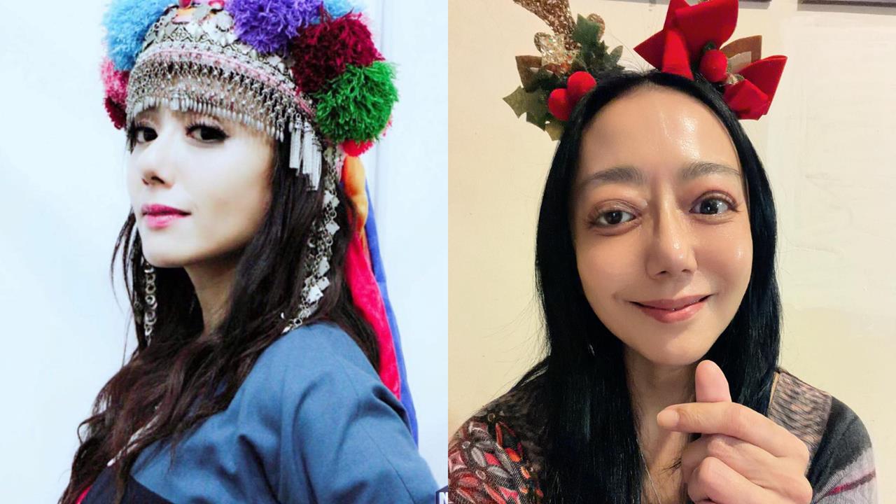 高慧君差點失明！「3次開刀」後曬自拍揭「大小眼現況」：剩最後一次了