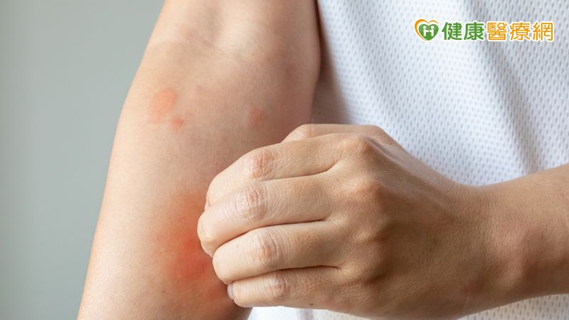 乾癢脫屑反覆發作 可能不只是氣候乾燥!中醫談常見類型與日常保養