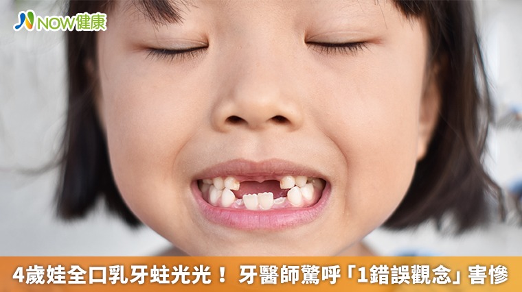 4歲娃全口乳牙蛀光光! 牙醫師驚呼「1錯誤觀念」害慘
