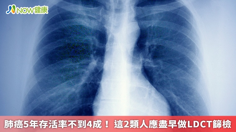 肺癌5年存活率不到4成！ 這2類人應盡早做LDCT篩檢