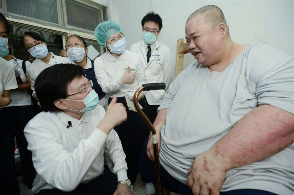 壯男靠大吃紓壓「胖到280公斤」困家中   花5年瘦成80公斤